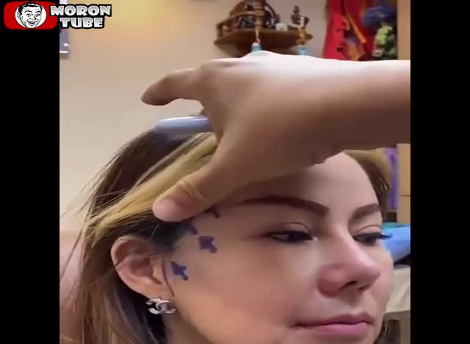 Video :I believe that she overdid the operation